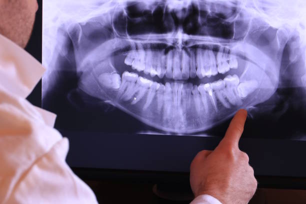 Best Broken Tooth Emergency  in West Livingston, TX