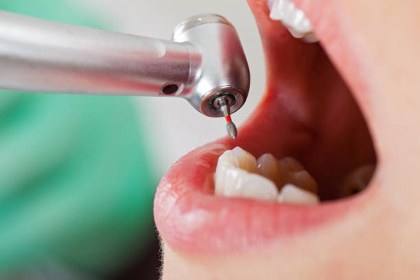  West Livingston, TX Emergency Dentist Pros